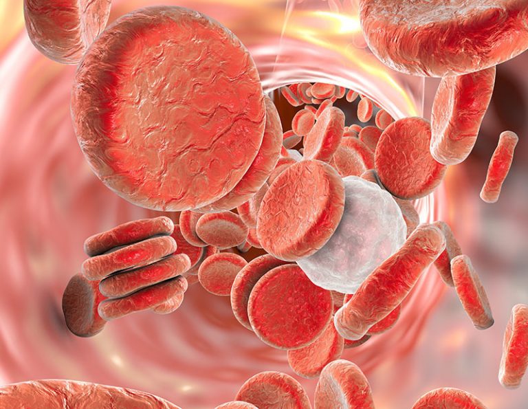 Iron IV Infusion Sina Health Centre